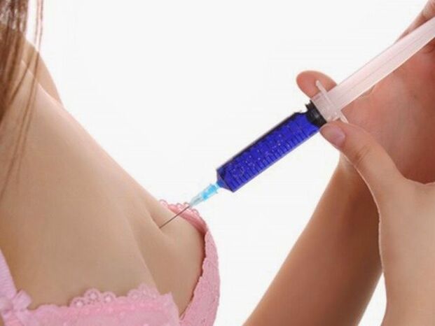 hyaluronic acid injection for breast augmentation