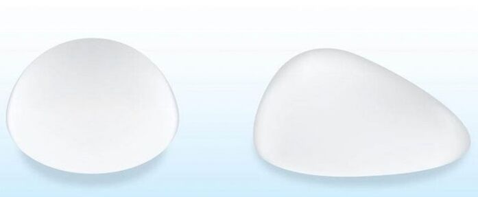 Breast implants and surgery for breast augmentation