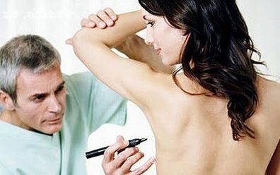 Breast augmentation surgery
