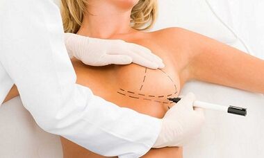 How to increase the brain of transplantation