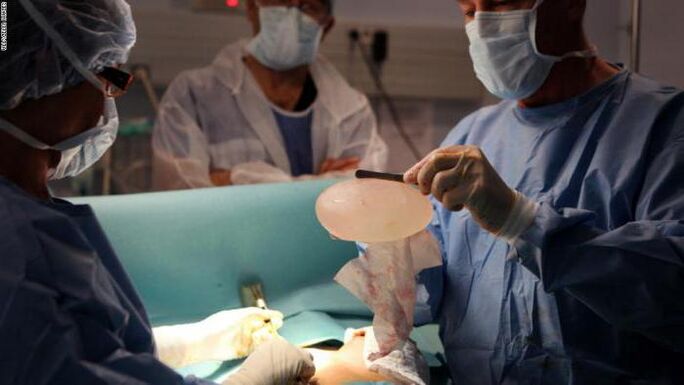 Features of shaping surgery